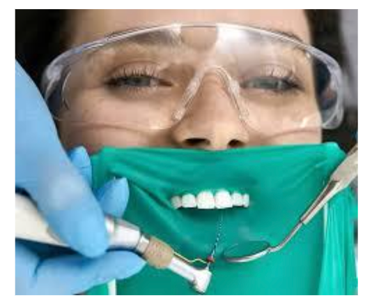 Wisdom Tooth Extraction